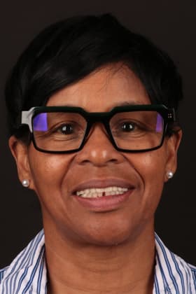 Before and after smile transformation by Advanced Dental Implant and TMJ Center in Southaven, MS.